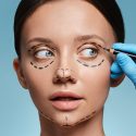 Five Amazing Benefits of Getting Double Eyelid Surgery Done 